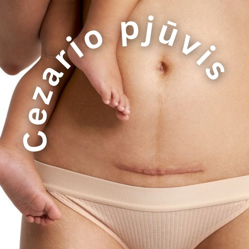 CEZARIO PJŪVIO PO GIMDYMO MASAŽAS