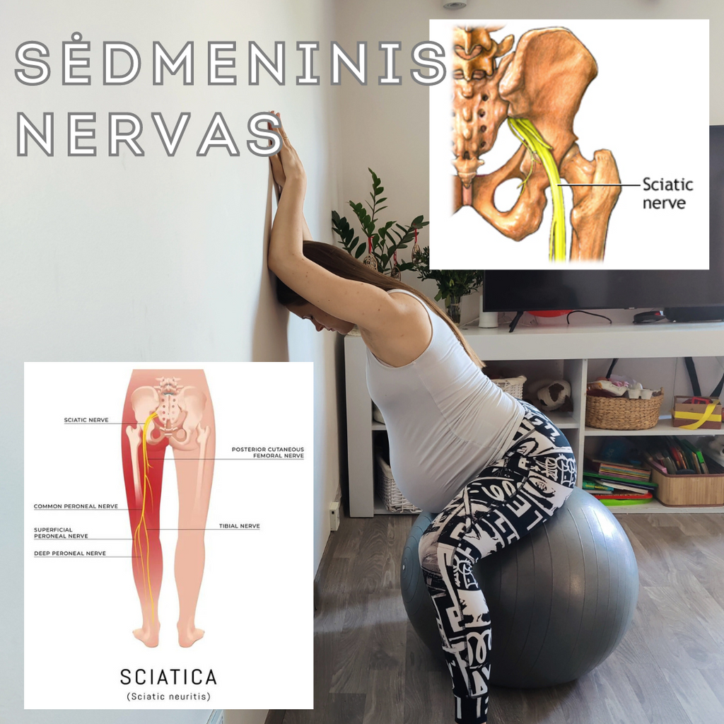 SĖDMENINIS NERVAS: SIMPTOMAI, PREVENCIJA IR IŠSAMI INFORMACIJA